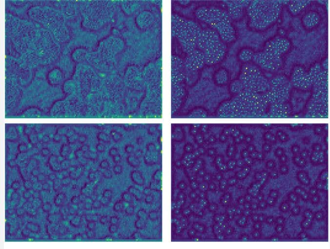 Medical Image Enhancement Watershed Filter