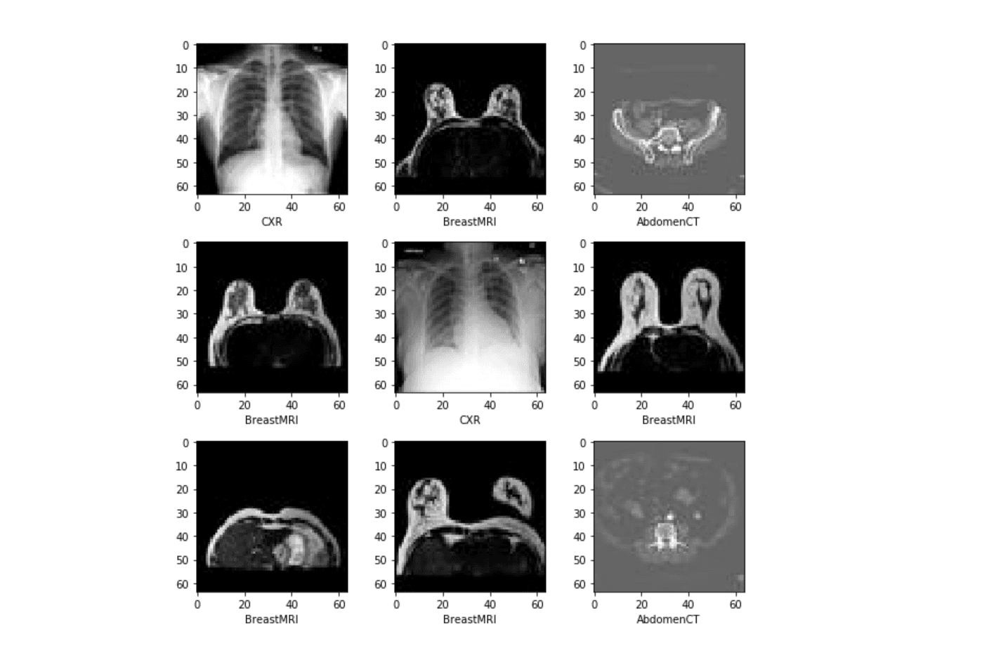 Medical MNIST