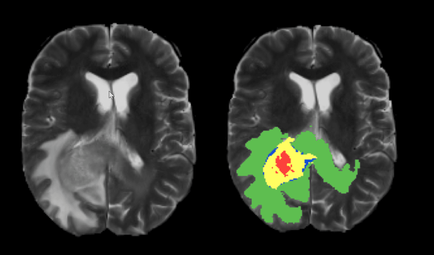 Traffic Signs Detection